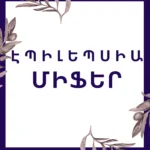 Read more about the article Միֆեր էպիլեպսիայի մասին